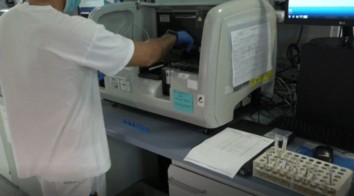 TEST SIEROLOGICI, MENO BUROCRAZIA PER IMPRESE E CITTADINI