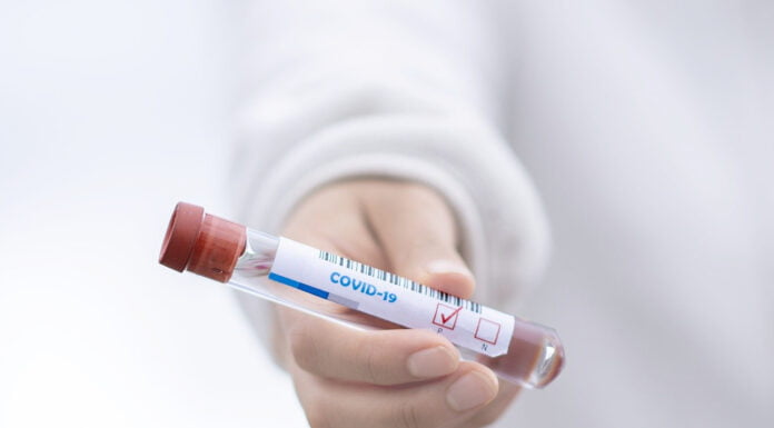 INDICE RT, IN EMILIA ROMAGNA A 1,28, SUPERATO IL LIVELLO DI GUARDIA