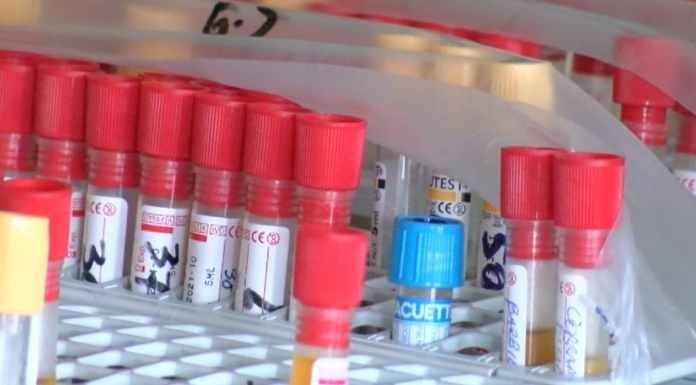 PAVULLO, IL PUNTO PRELIEVI CAMBIA SEDE: DA MERCOLEDI’ SARA’ IN VIA ALDO MORO