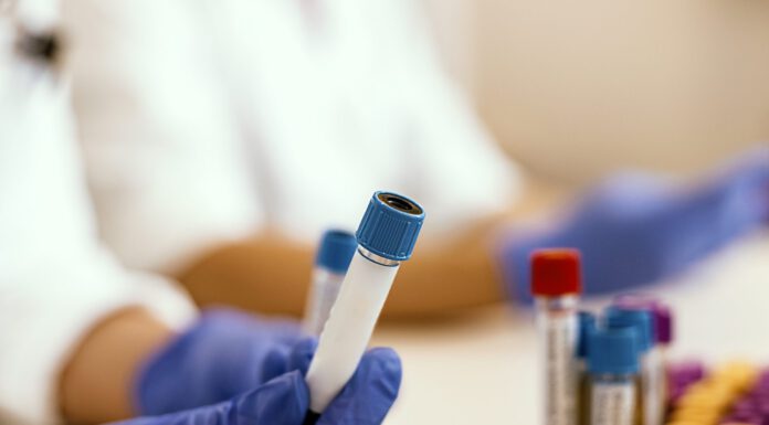 RICERCA CORONAVIRUS, DA MODENA LO STUDIO SU MARCATORI PREDITTIVI