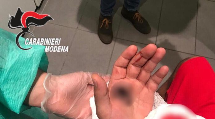 SI SPARA ALLA MANO DA SOLO: FINGE DI ESSERE STATO DERUBATO E FERITO
