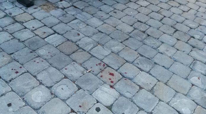 AGGRESSIONE IN CENTRO A MODENA: LO COLPISCE CON UNA MAZZA DA BASEBALL, SUBITO ARRESTATO