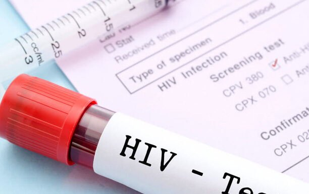 HIV, EPATITE C E SIFILIDE, A MODENA IL TEST DAY ALL’INFORMAGIOVANI
