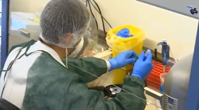 TERAPIA CON ANTICORPI MONOCLONALI, MODENA APRIPISTA: VENTI I PAZIENTI IN CURA