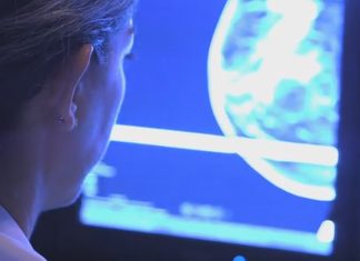 TUMORE AL SENO, UN’APP PER ACCOMPAGNARE LE DONNE NEL PERCORSO DI CURA